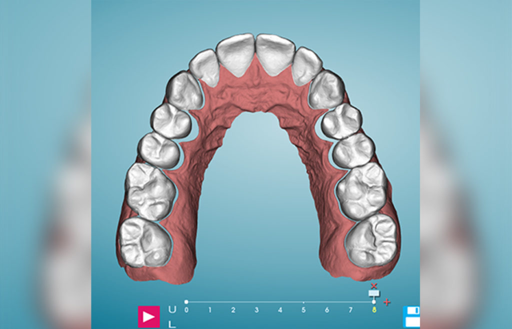 establish arch