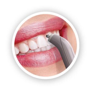 dental_pain_eraser_replacement_tips